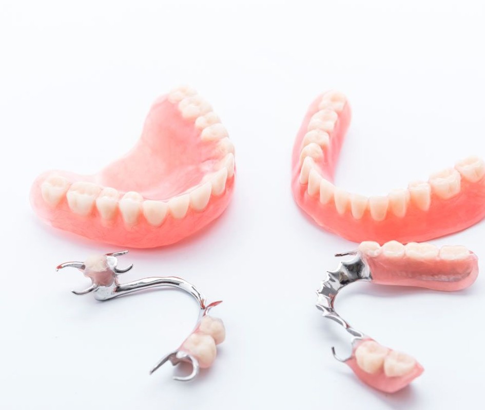Protheses dentaires ceramiques Drs Christian Maire et Zacharie Lang